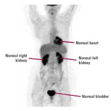 I know this might make me sound crazier than a crazy cat lady, but, i think my cat might be able detect cancer. Pet Scans Breastcancer Org