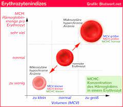 Blasses Blut Blutwert Mchc Vermindert Durchschnittliche Hamoglobinkonzentration Zu Niedrig