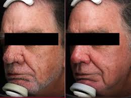 Dr Nina Wines Medical & Laser Dermatologist Sydney