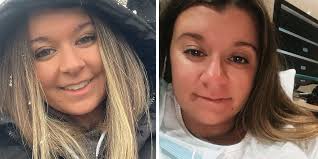 Pregnancy nose' has expectant moms going viral