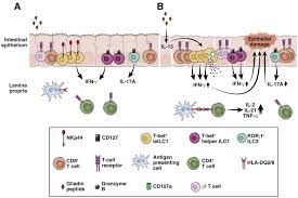 Innate Lymphoid Cells And Celiac Disease Current Perspective Sciencedirect