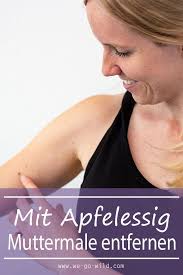 wie entstehen muttermale alles rund um das muttermal muttermal leberfleck leberfleck entfernen