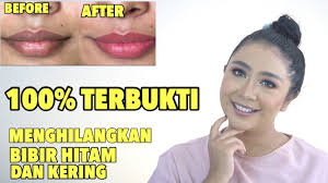 Maybe you would like to learn more about one of these? Cara Ampuh Memerahkan Bibir Hitam Tips Mengatasi Bibir Kering Youtube
