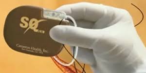 Le será colocado a erikson bajo la piel justo debajo de la clavícula. Hm Hospitales Adquiere Dai Sc El Desfibrilador Automatico Implantable Subcutaneo De Boston Scientific