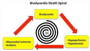 Oct 08, 2019 · one might also speculate, however, that confronted with the prospect of failing to restore airway patency, administering atropine for bradycardia could also be motivated by the alleviation of stress that is derived from identifying an immediately remediable problem requiring a familiar intervention and the intuitive appeal of restoring normal physiological values. Pulmcrit Epinephrine Vs Atropine For Bradycardic Periarrest