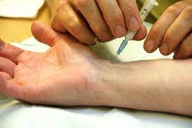 Steroids Carpal Tunnel Net