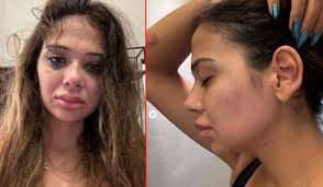 Merve Taşkın yaşadığı kabusu paylaştı - Aybastı Haber