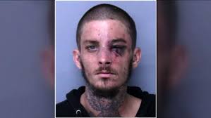 Another comes forward to accuse St. Johns County deputies of excessive force