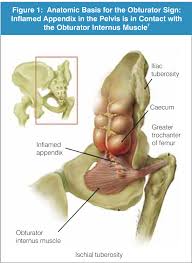 Image result for Obturator Sign