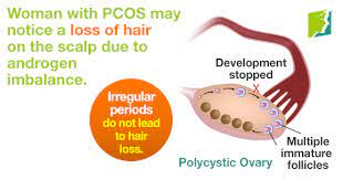 Although we mostly think of skin as being most reactive to the hormonal, and other, changes of the menstrual cycle, the fluctuations of the menstrual cycle can, in some cases, directly and. Can Irregular Periods Lead To Hair Loss Menopause Now