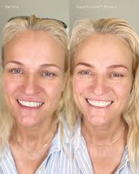 This memoriam piece was a sentimental one for me. Candy is my best friends  Mom and I consider their family a second family to me. Last year, we sadly  lost Richard, Candy's