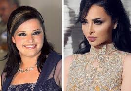 تنظيم عملية إخلاء الموقع في حالات الطوارئ. Ø¯ÙŠØ§Ù†Ø§ ÙƒØ±Ø²ÙˆÙ† Ù‚Ø¨Ù„ ÙˆØ¨Ø¹Ø¯ Ø³ØªØ§ÙŠÙ„ Ø§Ù„Ù…ØºÙ†ÙŠØ© Ø¯ÙŠÙ†Ø§ ÙƒØ±Ø²ÙˆÙ† Ø§Ù„Ø¬Ø¯ÙŠØ¯ Ø§ÙØ¶Ù„ Ø¬Ø¯ÙŠØ¯