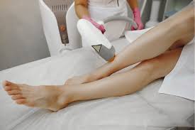 ipl hair removal service in singapore