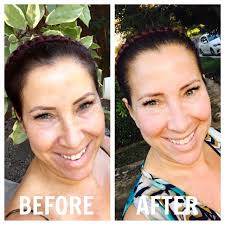 Conture Kinetic Skin servido Toning