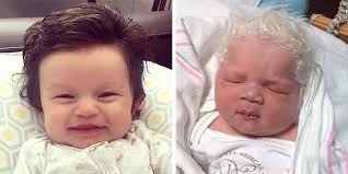 Ci possono essere dei disturbi tricologici: Bruciori Di Stomaco In Gravidanza Neonato Avra Tanti Capelli Zz7 Curiosita News Ed Informazioni