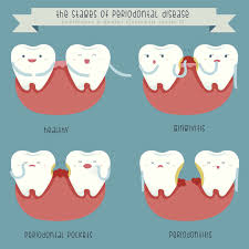 How Gum Disease Can Affect Your Children