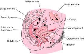 Endometriosis Is A Condition In Which Bits Of The Tissue Similar To The Lining Of The Uterus Endom Endometriosis Definition Endometriosis Endometriosis Stages