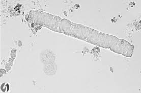 Urinalysis Understand The Test Your Results