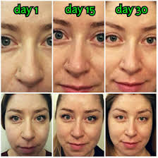 Neocell Glow Matrix: Review and Giveaway