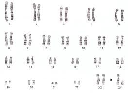 Take a look at the simulation pane. Karyotype Definition Disorders Analysis Biology Class Video Study Com