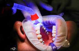 Is Oral Cancer Curable In India Vaidam Com