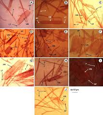 Image result for Allophylus africanus