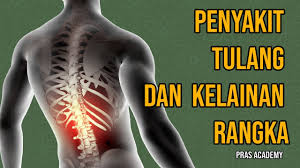 B.tulang rusuk palsu berjumlah tiga pasang. Penyakit Tulang Dan Kelainan Rangka Manusia Ipa Kelas 4 Sd Pras Academy Youtube