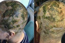 Maybe you would like to learn more about one of these? Waspada Zat Kimia Berbahaya Pada Pewarna Rambut Tak Hanya Sebabkan Rambut Rontok Tapi Luka Bakar Menganga Semua Halaman Grid Health