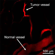 Deep veins, located in the center of the leg near the leg bones, are enclosed by muscle. Distinguishing Brain And Tumor Blood Vessels In Deep Tissues Using Multiphoton Microscopy Olympus Ls