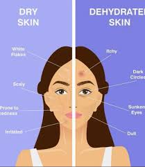 Kulit kering (dry skin) dan kulit dehydrated (dehydrated skin) memang ramai  keliru sebab nampak sama, tapi sebenarnya berbeza: 🌸 Kulit Kering (Dry  Skin) ➡️ Kekurangan minyak (sebum) semula jadi pada kulit. •