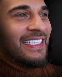 With Smile Design we are creating a perfect smile lines and confidences for  our patients. ✨ ✨ ✨ 🔴 Process : smile design ⏰treatment period: 4 Days  🩺side effect: Non 😱pain level: