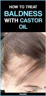 For dry hair, the oil is a very good treatment option, as its fatty acids are capable of locking moisture, thus making the hair look smoother and softer. How To Treat Baldness With Castor Oil Castor Oil For Hair Castor Oil For Hair Growth Hair Growth Oil