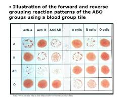 Aim How Is Blood Type Determined Do Now 1 How Are Blood