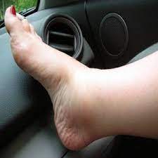 Pin On Custom Made Orthotics
