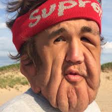 Fundraiser by Christopher Dismatsek : Help Support Nick's Facial Surgery