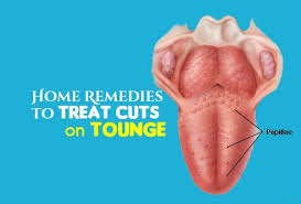 Biting The Inside Of Your Cheek Treatment Pin On Health