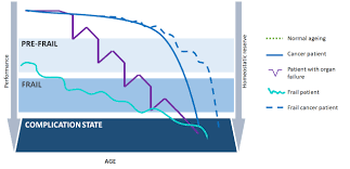 Management Of The Elderly Cancer Patients Complexity The Radiation Oncology Potential