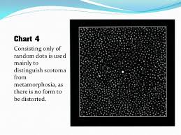 Amsler Grid