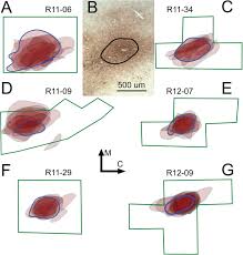 Alphabetical order is just as arbitrary as random order. Corticocortical Connections Of The Rostral Forelimb Area In Rats A Quantitative Tract Tracing Study Biorxiv