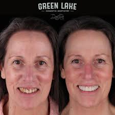 Green Lake Cosmetic Dentistry