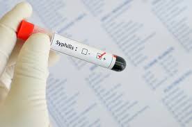 Syphilis Cases In California Drive A Record Setting Year For Stds Nationwide