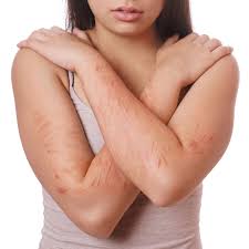 This might give temporary relief from the emotional pain the person is feeling. Risky Business The Higher Risk Of Nonsuicidal Self Injury In Bisexual Individuals