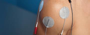 Image result for Electrical Stimulation Therapy