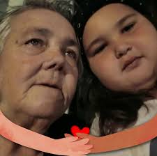 Sleeve surgery recovery: Describe your initial experience