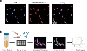 We did not find results for: A Novel Therapeutic Antibody Screening Method Using Bacterial High Content Imaging Reveals Functional Antibody Binding Phenotypes Of Escherichia Coli St131 Scientific Reports