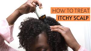 Dry scalp can have a number of different causes, though the most. How To Treat An Itchy Scalp Causes Treatment Prevention Youtube