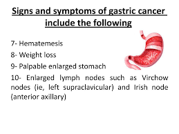 Here are the most common signs and symptoms of stomach cancer. Stomach Cancer Also Called Gastric Cancer Is Cancer Arising From Stomach Tissue It Is Uncontrolled Cell Growth Of Stomach Layers Lead To Dysfunction Of Ppt Download