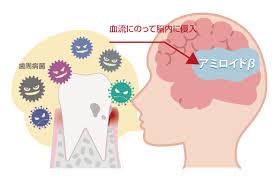 このアカウントには、性的興奮を催すリンクや破廉恥な画像を多数含みます。 もし嫌悪感を感じたらミュートないしはブロック下さい。 #uncensored #無修正 #pornstar #av女優. æ­¯å'¨ç—…ãŒèªçŸ¥ç—‡ã®ç™ºç—‡ æ‚ªåŒ–ã®åŽŸå›  ãƒªã‚¹ã‚¯ã‚'æŠ'ãˆã‚‹äºˆé˜² æ¨ªæµœmmãƒ‡ãƒ³ã‚¿ãƒ«ã‚¯ãƒªãƒ‹ãƒƒã‚¯