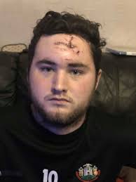 Crash survivor, 19, back home after horrific crash near Denbigh which  killed three teenagers