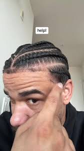 What Does It Mean When Bumps Appear around My Babies Braids